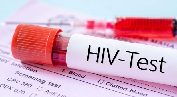 In den meisten Fällen dürfen Arbeitgeber keinen HIV-Test von Bewerbern verlangen.